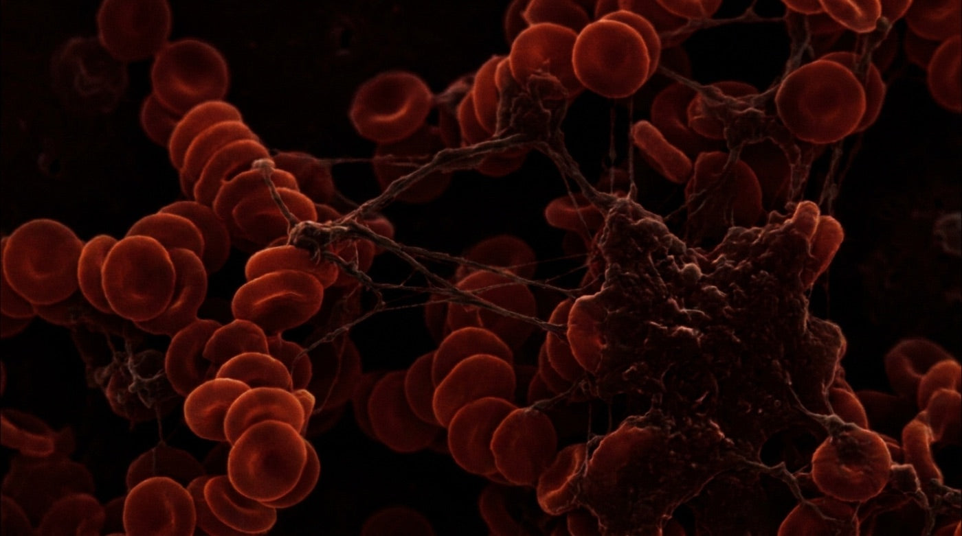Microscopy of blood showing fibrin micro-clots tangling red blood cells